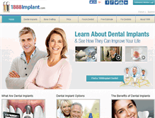 Tablet Screenshot of 1888implant.com